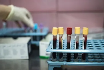 Kanserin şifresi 10’da