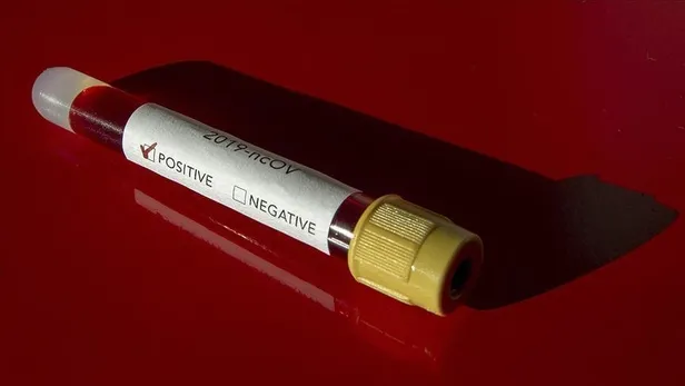 Koronavirüsle mücadelede son 24 saat: 7 bin 533 test yapıldı, 2 bin 69 pozitif vaka tespit edildi-6