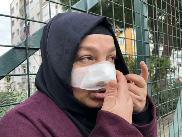 yuruyus-yaparken-pitbull-saldirisina-ugradi-burnu-parcalandi-1638539575285.jpg Yürüyüş yaparken pitbull saldırısına uğradı! Burnu parçalandı-8