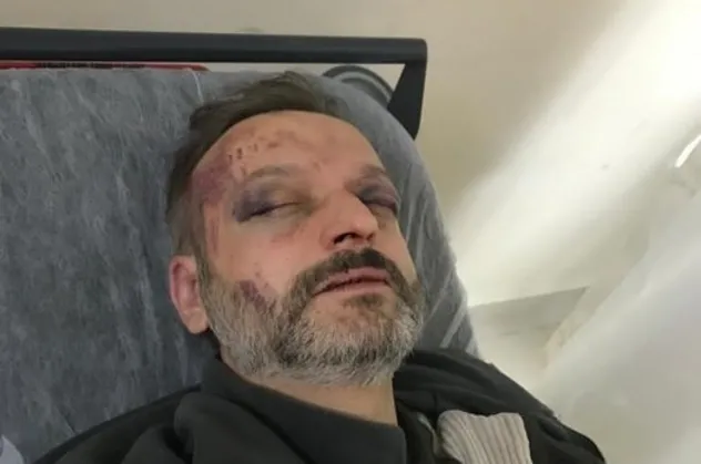 Onur Şener cinayetini hatırlatan saldırı: "İstek parçayı çalmadın" diyerek öldüresiye dövdüler