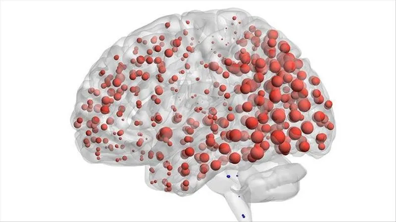 bilim-insanlari-alzheimer-riskini-arttiran-yeni-tehlikeyi-buldu-kimse-bilmiyor-ama-herkes-yapiyor-1726519170959.jpg Bilim insanları Alzheimer riskini arttıran yeni tehlikeyi buldu! Kimse bilmiyor ama herkes yapıyor-3