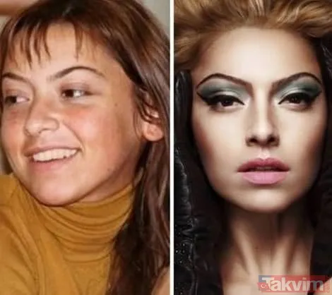 Esra Bilgiç estetik harikası çıktı! Eski halini görenin gözleri fal taşı gibi açıldı: Doğal sanıyordum! Diriliş Ertuğrul’un yıldızı... - 21