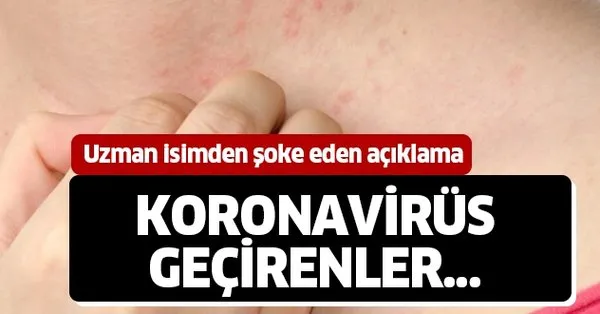 uzman isim ilk kez acikladi deri