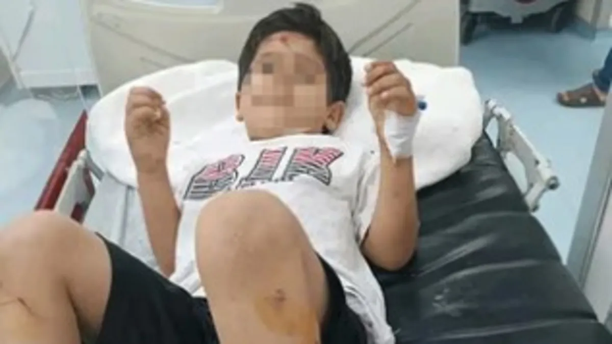 Şanlıurfa Viranşehir'de sahipsiz köpek saldırısı: 8 yaşındaki çocuk yaralandı, İçişleri Bakanlığı müfettiş görevlendirdi