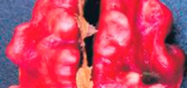 Cevizi kızarttılar