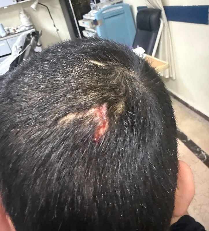 gaziantepte-engelli-bakim-merkezinde-darp-skandali-merkezde-kalan-gencin-kafasina-6-dikis-atildidarp-edilen-en-1766496218846.jpeg Furkan Kaya (İHA)