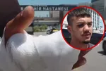 Ankara'da inanılmaz olay! Trafik kavgasında parmağını kopardılar