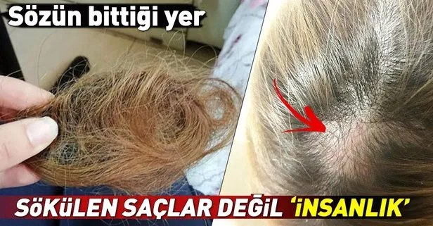 İzmir’de meslek lisesi öğrencisi ambulans görevlisini darp etti, saçlarını yoldu