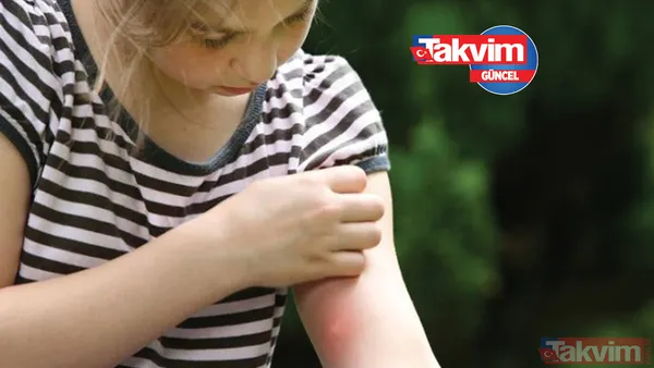 Sinek kovucu doğal yöntemler neler? Sinek ısırığına ne iyi gelir? 1 dakikada sivrisineğe kesin çözüm! - 1