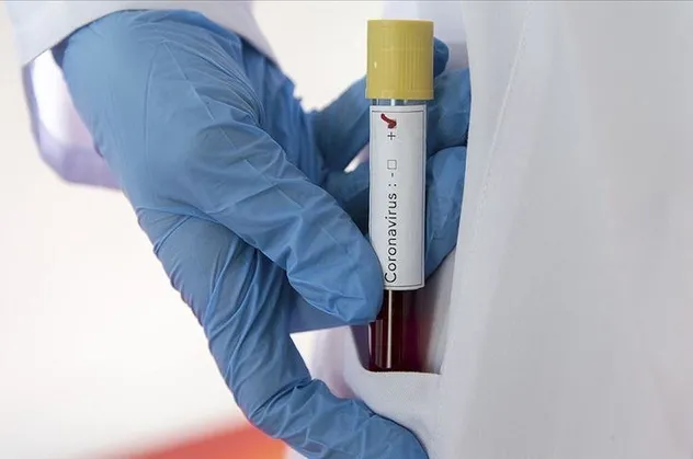 Coronavirüs aşısı için kritik gün: ABD'de ilk kez test edilecek
