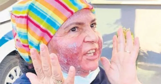 Trabzon’da güzellik merkezi faciası: Müşterinin yüzü yandı