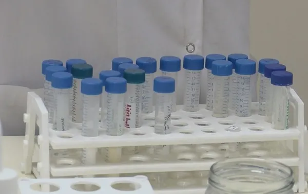 Son dakika: Türkiye'de ilk! Dünyanın merakla beklediği koronavirüs aşısı insanlarda denenecek!-7