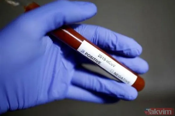 "Şu anda en büyük sorunumuz personel eksiliği ve yerel yönetim ile merkezi hükümet arasındaki koordinasyonsuzluk. Hastanelerdeki yoğunluk her geçen gün...