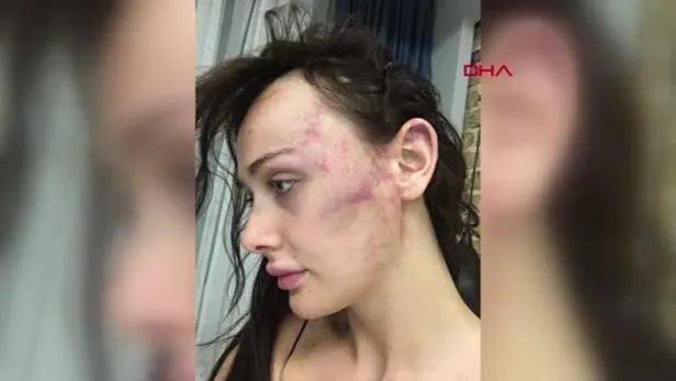 Sırp model Tanja Dukiç'in darbedilmesi davasında flaş gelişme: Dosya uzlaşma büroya gönderildi-6