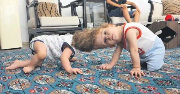 Başkan Erdoğan ile eşi Emine Erdoğan'ı ziyaret etmişlerdi: Siyam ikizleri Yiğit ile Derman, mutluluğa erişti:-1