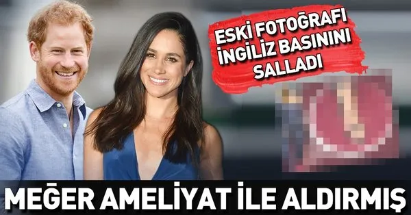 meghan markle nin eski fotograflari ingiliz medyasini salladi meghan markle ayagindaki kemigi aldirmis takvim