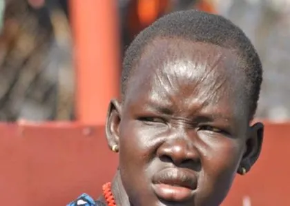 Güney Sudan’da korkunç gelenek! Yüzlerini bıçakla...