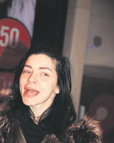 Merve Boluğur'un yüzünü sivilce bastı!-1