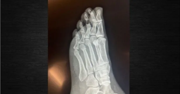 CHP Genel Başkanı Özgür Özel'den fotoğraflı cevap