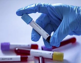 Ankara’da saatler değişti