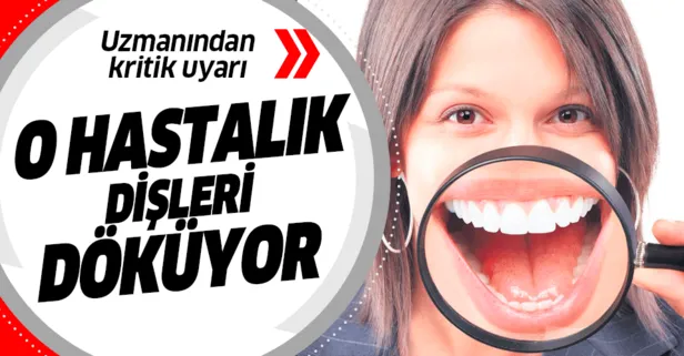 Yuksek Seker Disleri Doker Sanal Basin