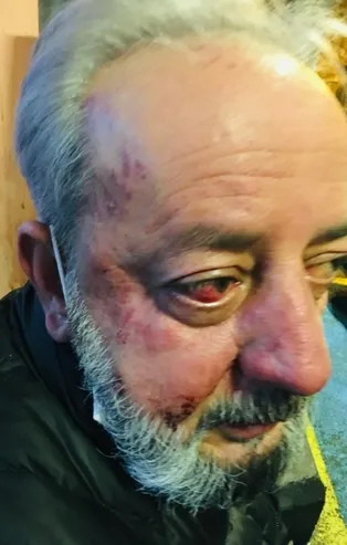 Üsküdar'da yaşlı adamı kiracıları dövdü