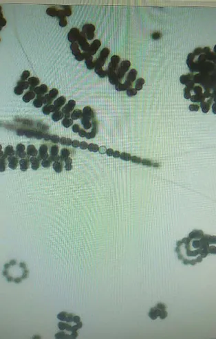 İstanbul'da siyanobakteri tehlikesi! Uzman isimden kritik uyarı