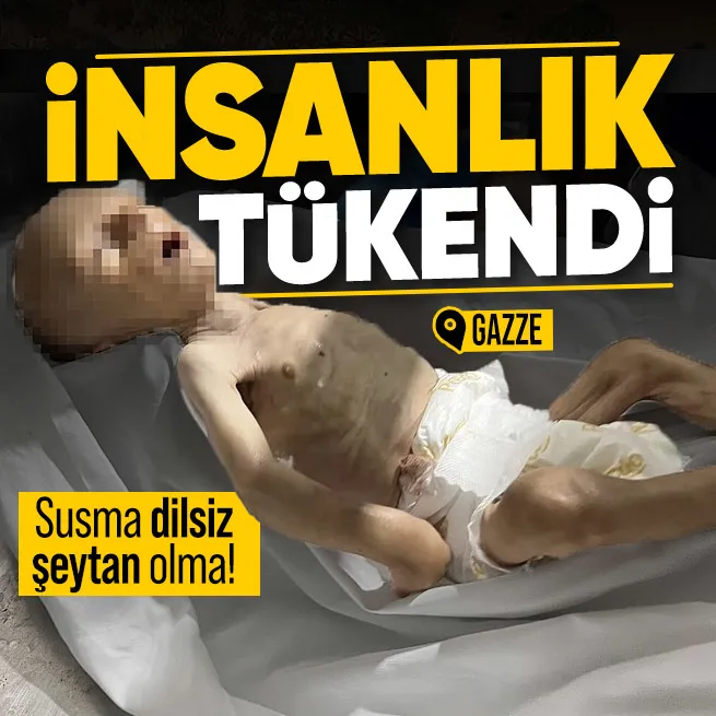 Gazze her dakika yok oluyor! 2,5 aylık bebek açlıktan şehit oldu... İnsanlığın tükendiğini gösteren kare