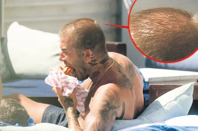 Takke düştü kel göründü