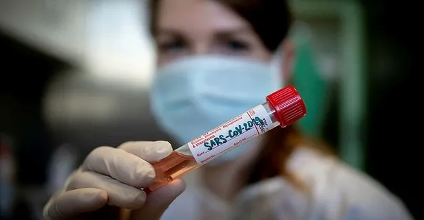 Dünya genelinde koronavirüs bulaşan sayısı 4 milyonu aştı!