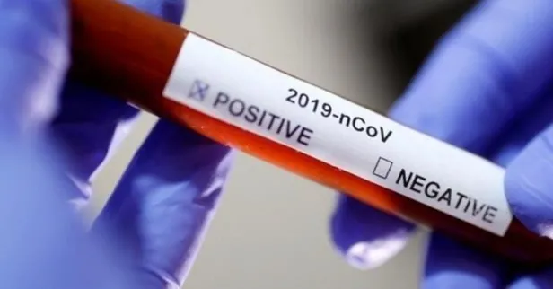 Bilim insanları ilk kez açıkladı! Yaz sıcakları koronavirüsü yok edebilir mi?-1