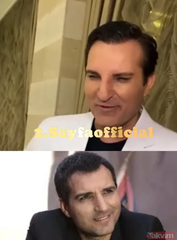 Rafet El Roman son haliyle dillere düştü "Karizmam yakışıklılığım mahvoldu" diye isyan etti! Yüzü gözü şiş içinde kalmıştım - 5