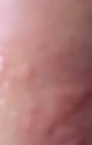 Koronavirüsün ortaya çıktığı Vuhan'dan şoke edici görüntüler! Yarasalar uzmanları ısırdı