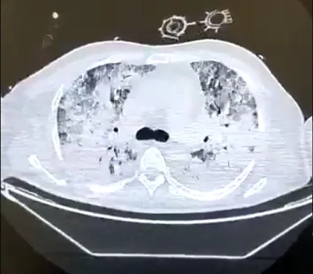 Koronavirüs işte böyle yayılıyor! Bunu daha önce hiç görmediniz!-3