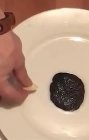 Canlı kanser hücresi sarımsaktan kaçtı videosu sosyal medyada paylaşım rekorları kırdı