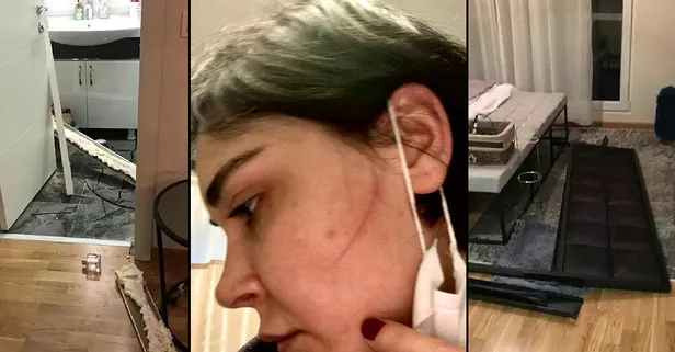 Sermiyan Midyat tarafından darbedilen Sevcan Yaşar o ses kaydını ortaya döktü! 'Çıplak görüntülerimi çekti' demişti...-10