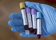 Son dakika: Koronavirüsün yeni belirtileri ortaya çıktı! Koronavirüs belirtileri nelerdir?