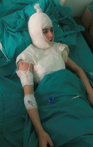 Üvey anne dehşeti! Başından aşağı kaynar su döktü