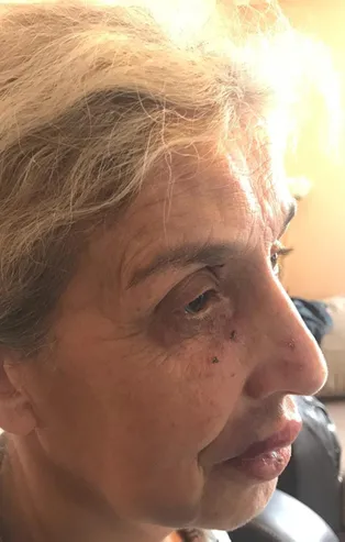 Esenyurt'ta sokak hayvanlarını besleyen kadın hastanelik oldu!