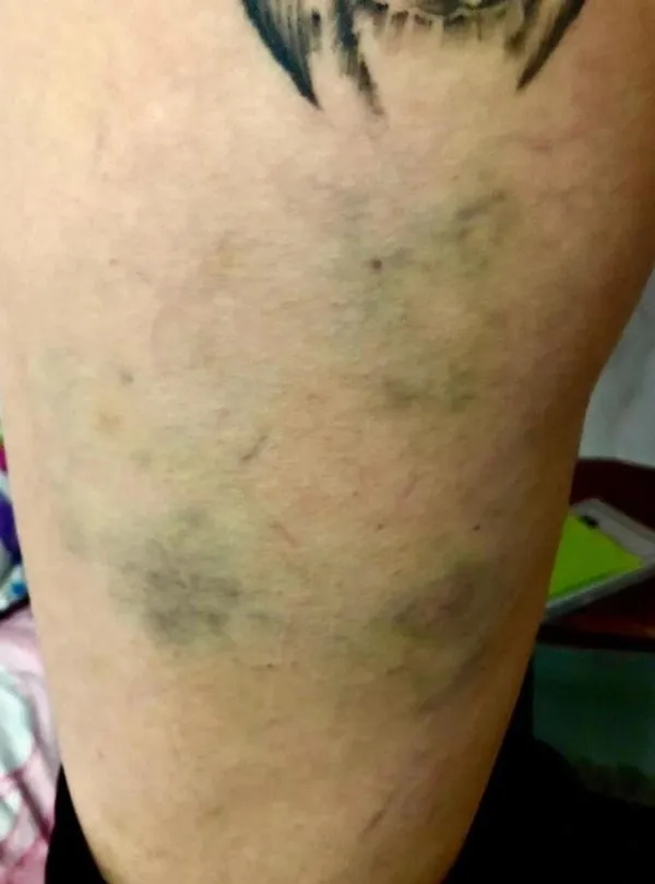 Sevcan Yaşar'a mahrem görüntü şoku! Sermiyan Midyat ile Sevcan Yaşar arasında neler oluyor? "Dövüp çıplak videomu çekti..."-7