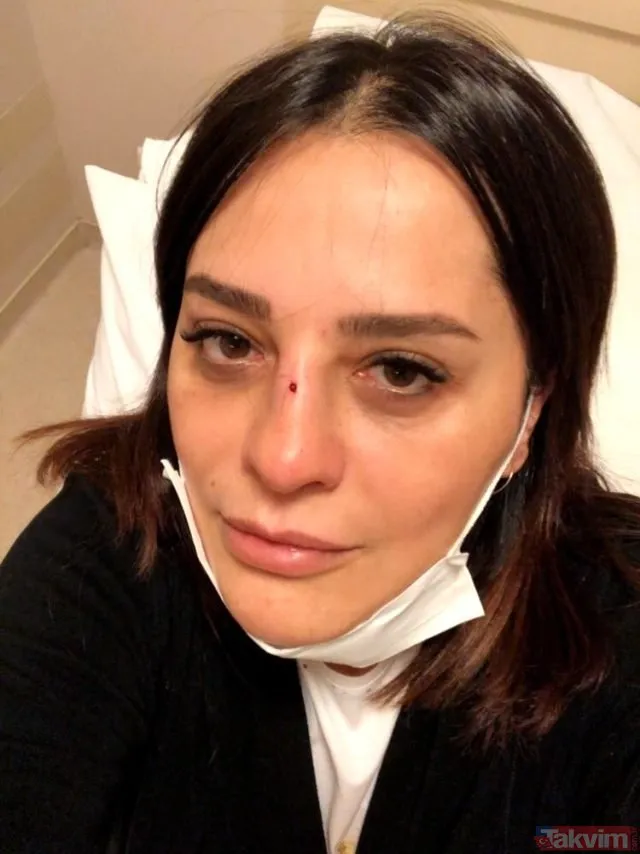 Reyhan Karaca kanlar içinde kaldı! Korkutan kaza sonrası Reyhan Karaca