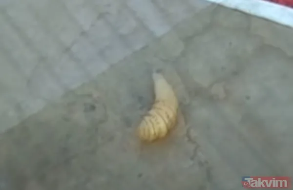 Karnındaki şişlik için gitti içinden çıkan doktorları bile şoke etti! Yer uzak değil Kayseri! 64 kilo girdi 55 kilo çıktı - 48