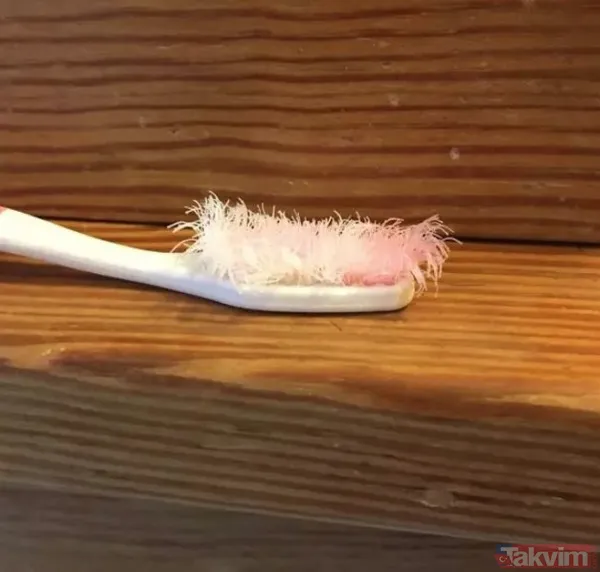 'Bu kadar da olmaz' dedirten iğrenç görüntüler! Mide bulandıran görüntüler - 5