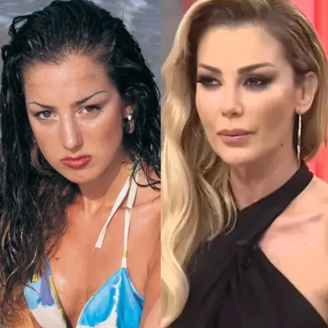 Yüz lifting yaptıran Ebru Yaşar’ın son hali olay oldu: İnsan bunu kendine nasıl yapar? - 8