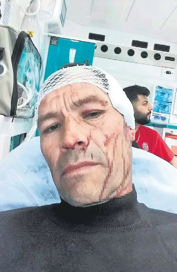 Eğitim şart! Müdür vekilinden veliye demir çubukla saldırı!-2