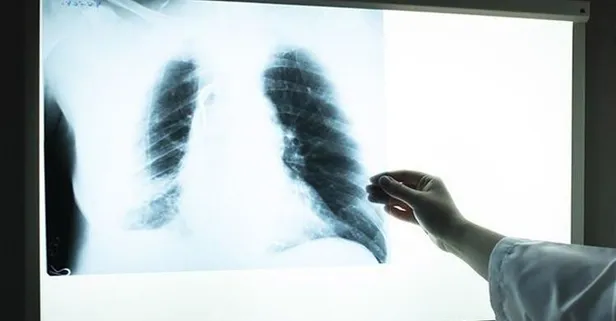 Koronavirüs teşhisinde büyük başarı! Türk mühendis geliştirdi