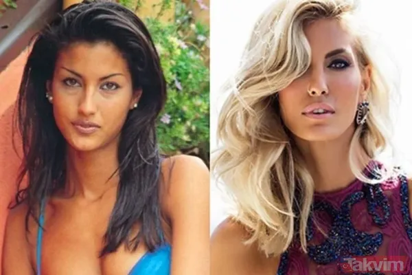 Esra Bilgiç estetik harikası çıktı! Eski halini görenin gözleri fal taşı gibi açıldı: Doğal sanıyordum! Diriliş Ertuğrul’un yıldızı... - 12