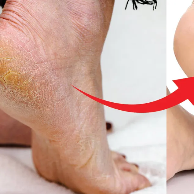 Akşam sür sabaha kurtul