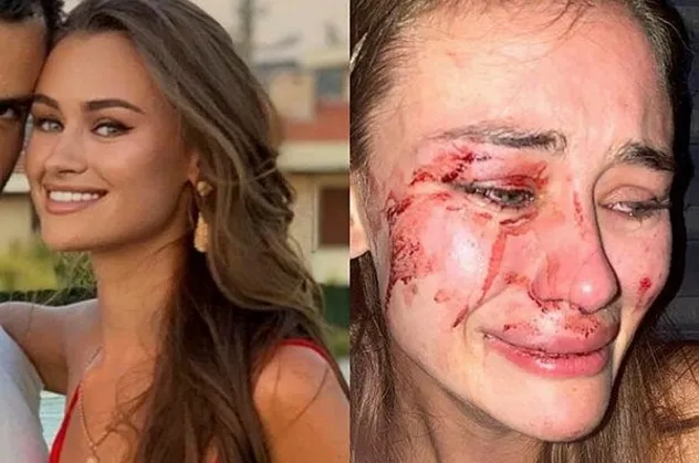 Son dakika: Daria Kyryliuk’un darp iddiasında sürpriz tanığın ifadesi ortaya çıktı: Kabus geceyle ilgili bomba iddia