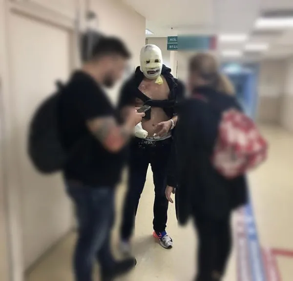 Nusret'te şov yaparlarken turist müşterileri yaktılar!-3